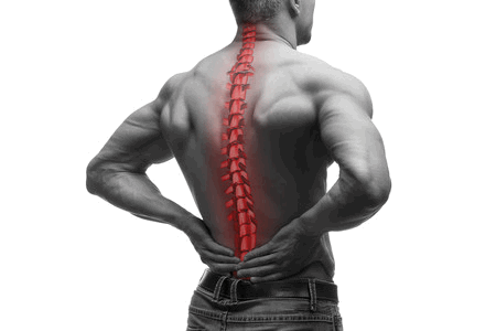 Degenerative Disc Disease