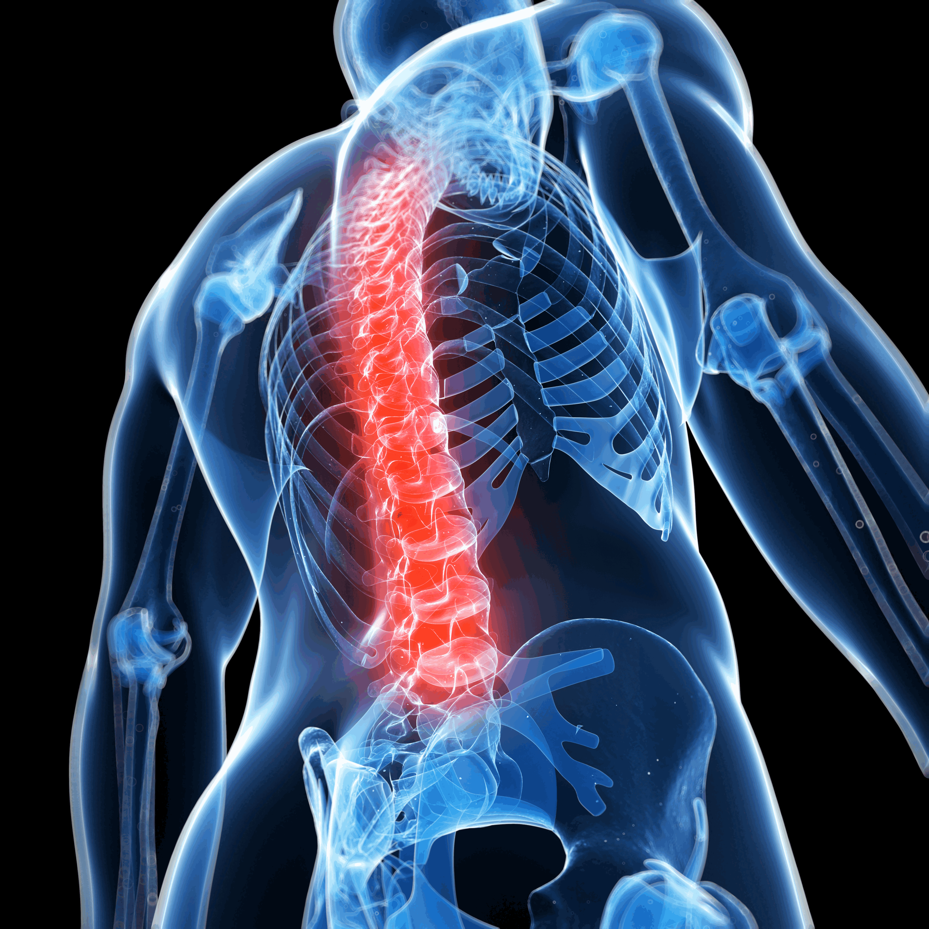 Spinal Cord Stimulation Specialist